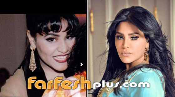 بالصور: نجمات عربيات قبل وبعد تصغير الأنف.. لن تصدق مظهرهن! صورة رقم 4