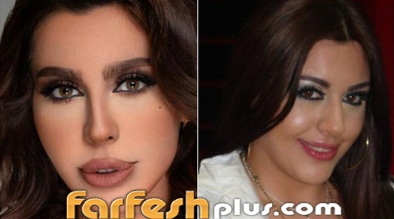 بالصور: نجمات عربيات قبل وبعد تصغير الأنف.. لن تصدق مظهرهن! صورة رقم 6