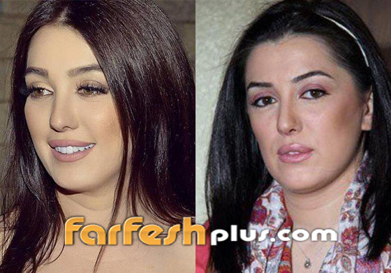 بالصور: نجمات عربيات قبل وبعد تصغير الأنف.. لن تصدق مظهرهن! صورة رقم 7