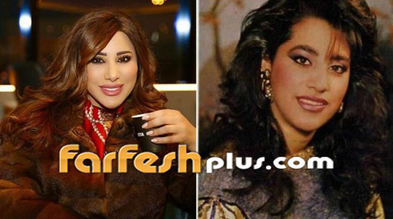 بالصور: نجمات عربيات قبل وبعد تصغير الأنف.. لن تصدق مظهرهن! صورة رقم 8
