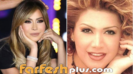 بالصور: نجمات عربيات قبل وبعد تصغير الأنف.. لن تصدق مظهرهن! صورة رقم 9