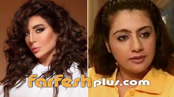 بالصور: نجمات عربيات قبل وبعد تصغير الأنف.. لن تصدق مظهرهن! صورة رقم 11