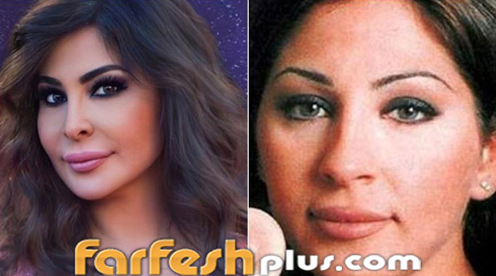 بالصور: نجمات عربيات قبل وبعد تصغير الأنف.. لن تصدق مظهرهن! صورة رقم 12