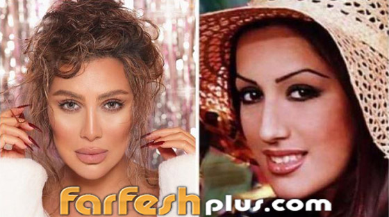 بالصور: نجمات عربيات قبل وبعد تصغير الأنف.. لن تصدق مظهرهن! صورة رقم 13
