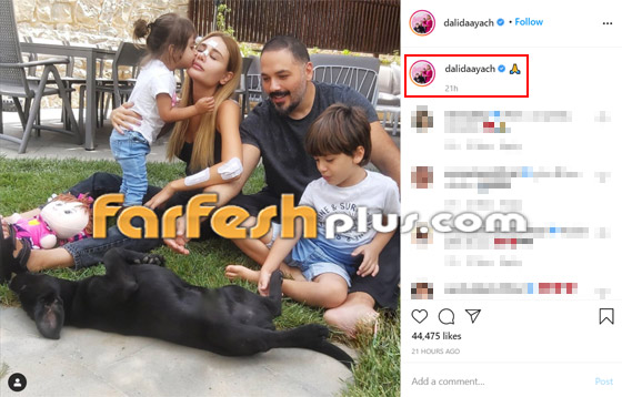 صور: أول ظهور لداليدا زوجة رامي عياش بعد إصابتها في انفجار بيروت صورة رقم 1