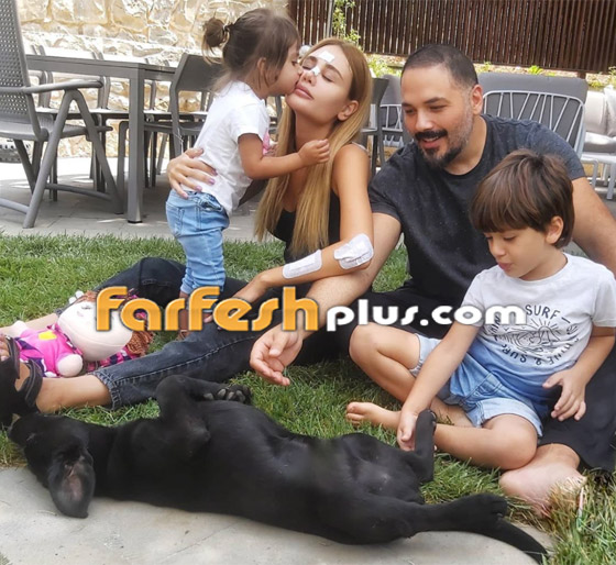 صور: أول ظهور لداليدا زوجة رامي عياش بعد إصابتها في انفجار بيروت صورة رقم 2