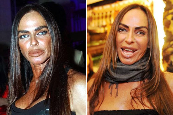 هكذا شوّهت عمليات التجميل هؤلاء المشاهير.. بينهم عرب (صور) صورة رقم 7
