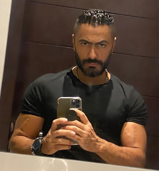تامر حسني يثير الجدل حول خضوعه لعملية تجميل جديدة بعد التغير الواضح في ملامحه! صورة رقم 3