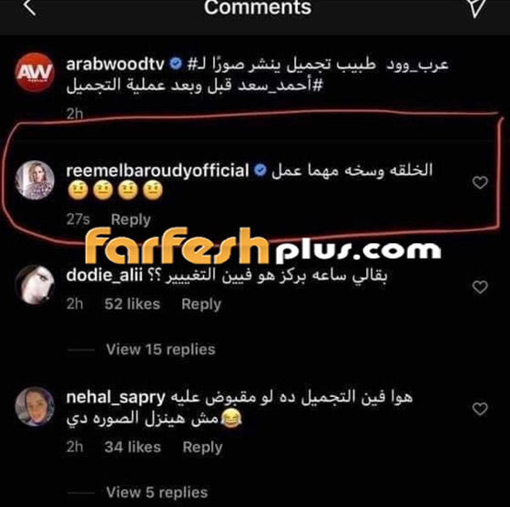 ريم البارودي تسخر من طليقها أحمد سعد وعملية التجميل التي أجراها بعد خطوبته صورة رقم 1
