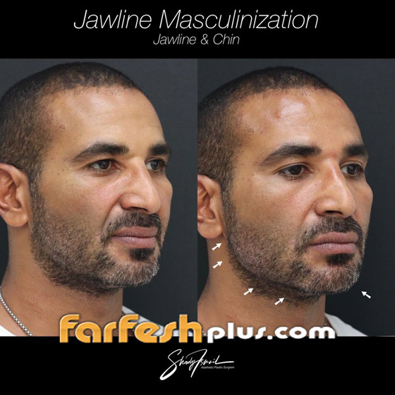 ريم البارودي تسخر من طليقها أحمد سعد وعملية التجميل التي أجراها بعد خطوبته صورة رقم 2