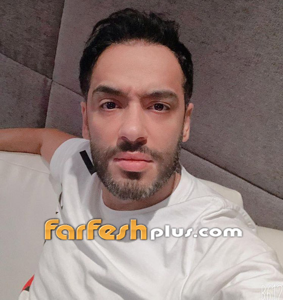 رامي جمال يكشف قرب تعافيه من مرض البهاق وزوجته تمازحه.. صور صورة رقم 4