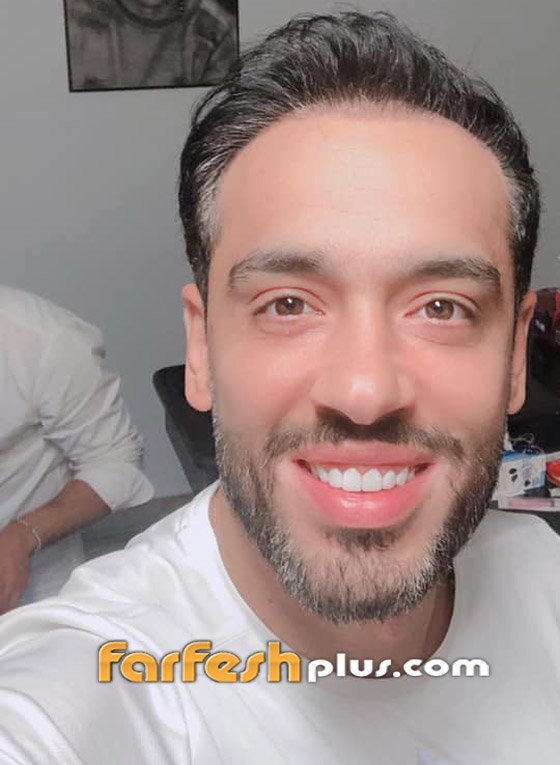 رامي جمال يكشف قرب تعافيه من مرض البهاق وزوجته تمازحه.. صور صورة رقم 5