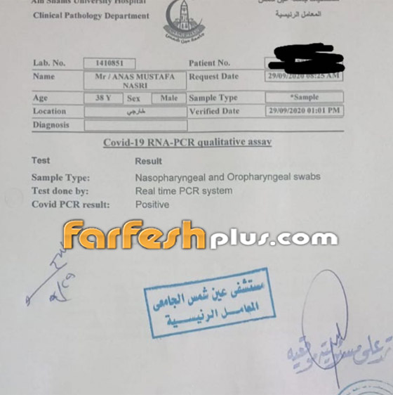 أنس نصري شقيق الفنانة أصالة يعلن إصابته بفيروس كورونا صورة رقم 2