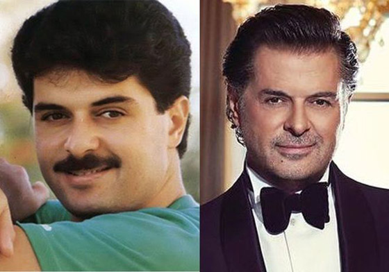 صور.. مشاهير رجال أدمنوا حقن البوتوكس وشد الوجه! صورة رقم 9