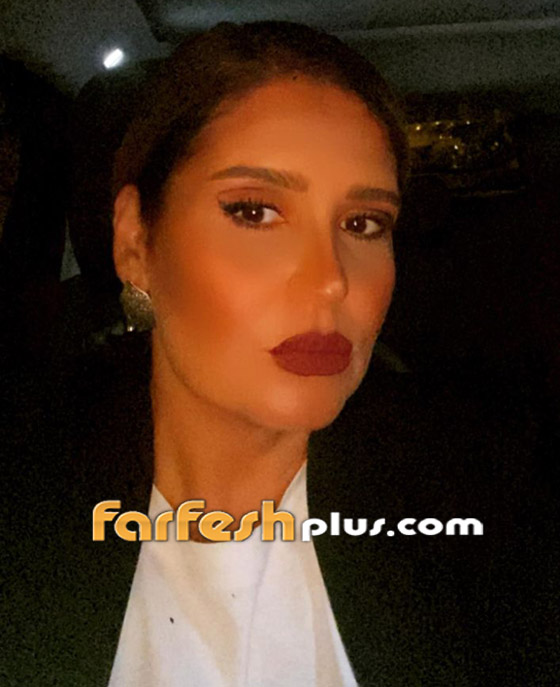 هنا شيحة بملامح وجه مختلفة.. ومتابعون: بكفي تجميل خربتي وجهك! صورة رقم 2