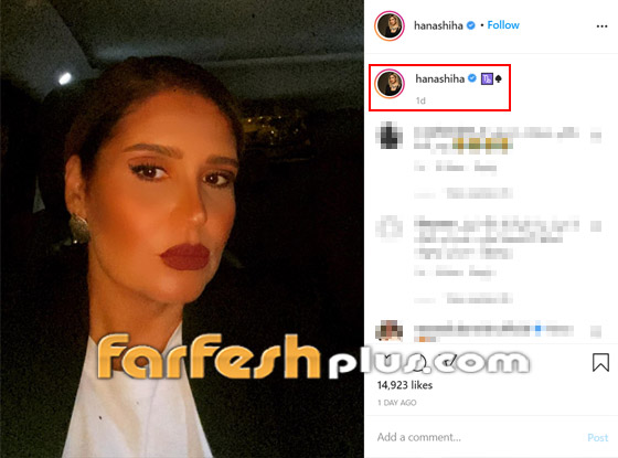 هنا شيحة بملامح وجه مختلفة.. ومتابعون: بكفي تجميل خربتي وجهك! صورة رقم 1