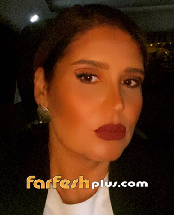 هنا شيحة بملامح وجه مختلفة.. ومتابعون: بكفي تجميل خربتي وجهك! صورة رقم 3
