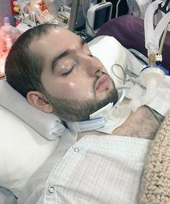 فيديو سار للأمير السعودي النائم يحدث ضجة بعد غيبوبة 15 عاماً صورة رقم 1