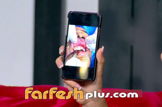 نادين نسيب نجيم تكشف عن صور وجهها المشوه لأول مرة بعد انفجار بيروت صورة رقم 2