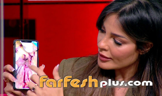 نادين نسيب نجيم تكشف عن صور وجهها المشوه لأول مرة بعد انفجار بيروت صورة رقم 3