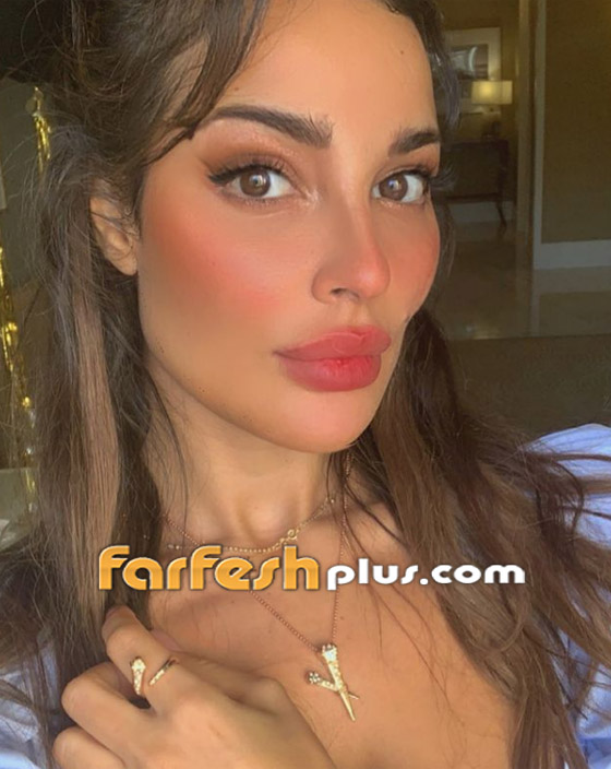 نادين نسيب نجيم تكشف عن صور وجهها المشوه لأول مرة بعد انفجار بيروت صورة رقم 8
