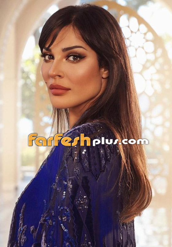 نادين نسيب نجيم تكشف عن صور وجهها المشوه لأول مرة بعد انفجار بيروت صورة رقم 12
