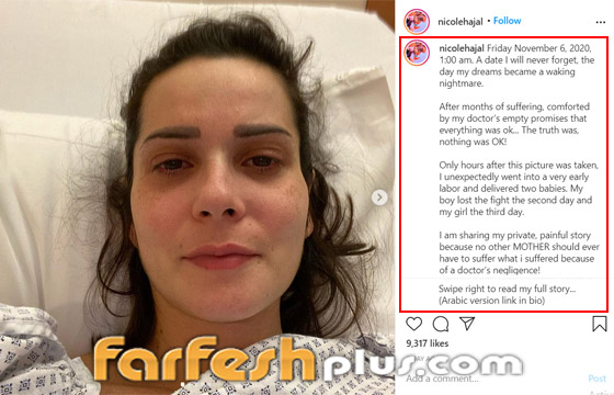 نيكول الحجل تتهم طبيبها بالإهمال وتكشف معاناتها مع الولادة المبكرة وفقد توأمها! صورة رقم 3