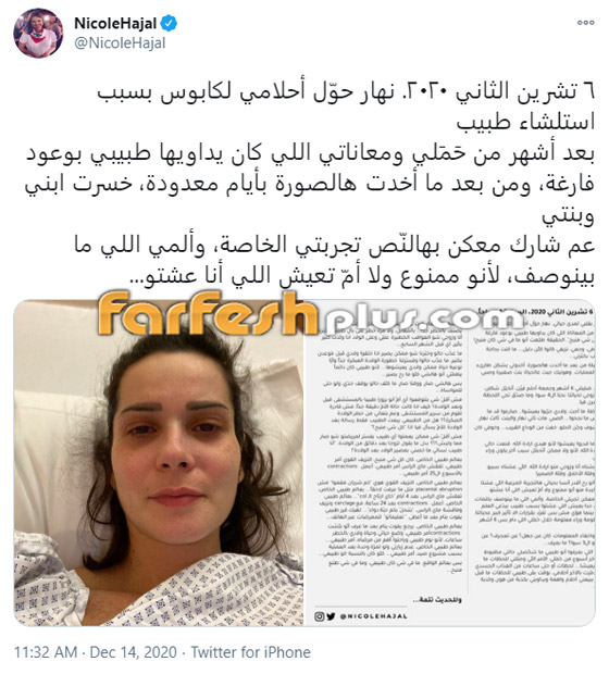 نيكول الحجل تتهم طبيبها بالإهمال وتكشف معاناتها مع الولادة المبكرة وفقد توأمها! صورة رقم 2