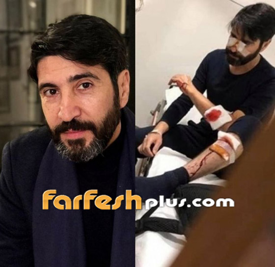 حصاد 2020: نجوم عرب نجوا بأعجوبة هذا العام من حوادث خطيرة! صورة رقم 2
