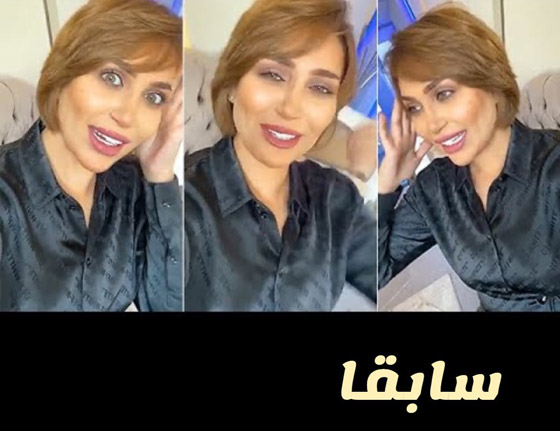 الدكتورة خلود قبل وبعد.. كيف تحولت الى هيفا ماجيك؟ صورة رقم 1
