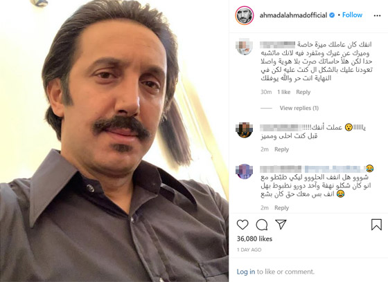 أحمد الأحمد يجري عملية تجميل لأنفه صورة رقم 1