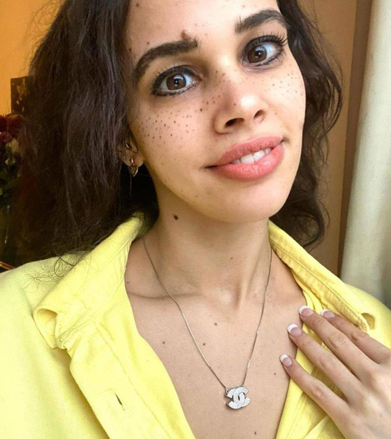 نور عمرو دياب تتعرض للتنمر بسبب هذه الصورة! صورة رقم 1