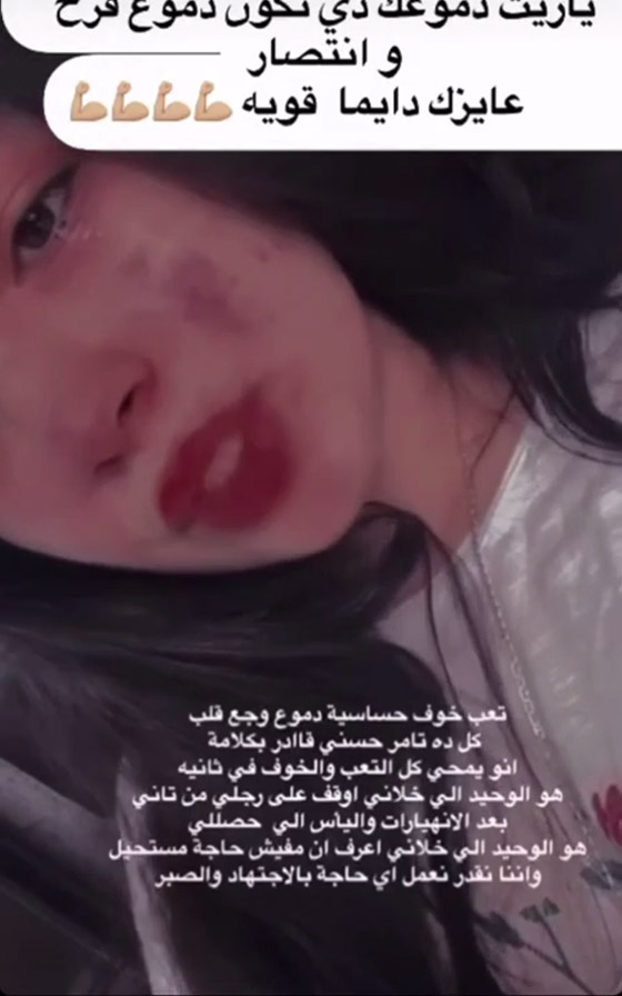 تامر حسني يتعاطف مع معجبة منهارة بعد معاناتها من أزمة نفسية (فيديو) صورة رقم 1