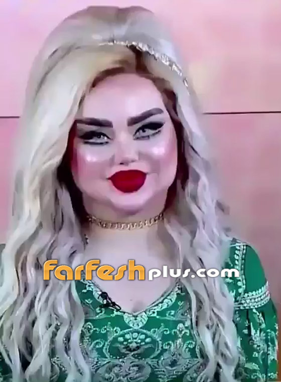 فيديو وصور: عمليات التجميل تحول فنانة عراقية إلى دمية! صورة رقم 1