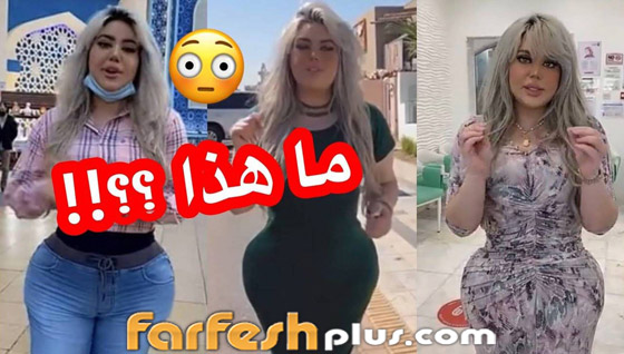 فيديو وصور: هجوم واسع على فنانة سورية بسبب النفخ والتكبير! أصبحت تضاريس جسمها كالإجاصة! صورة رقم 1