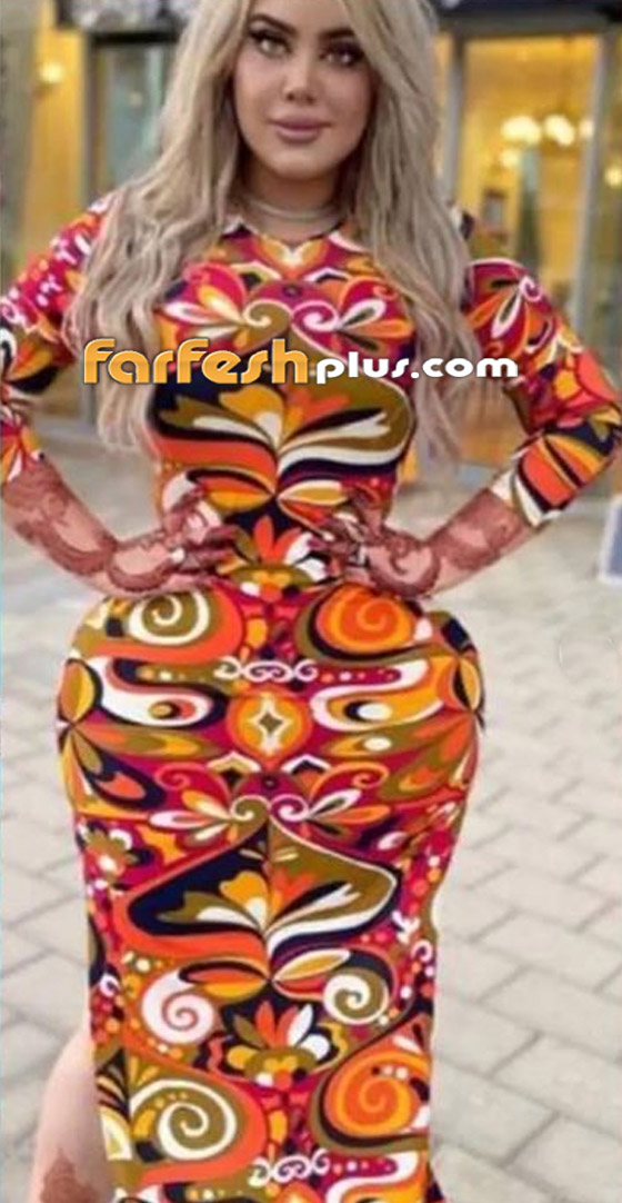 فيديو وصور: هجوم واسع على فنانة سورية بسبب النفخ والتكبير! أصبحت تضاريس جسمها كالإجاصة! صورة رقم 8
