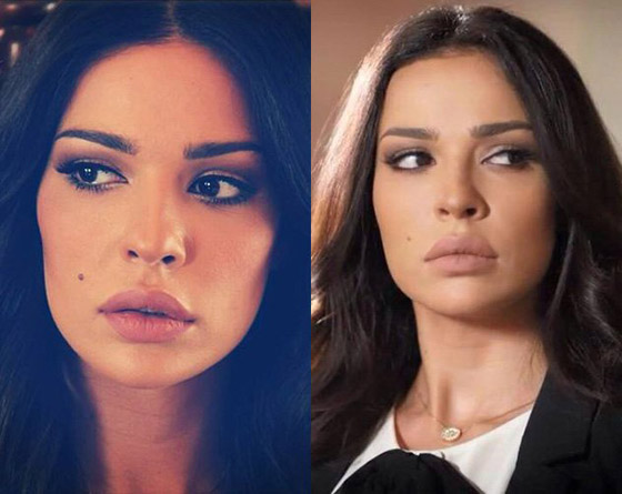 فيديو وصور نادين نجيم قبل وبعد: الجمهور مصدوم! تغييرات واضحة تكشف كثرة عمليات التجميل صورة رقم 9