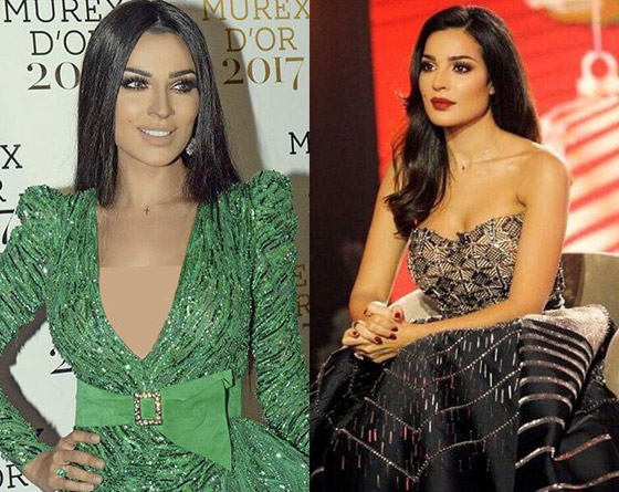 فيديو وصور نادين نجيم قبل وبعد: الجمهور مصدوم! تغييرات واضحة تكشف كثرة عمليات التجميل صورة رقم 7