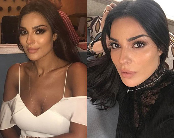 فيديو وصور نادين نجيم قبل وبعد: الجمهور مصدوم! تغييرات واضحة تكشف كثرة عمليات التجميل صورة رقم 12