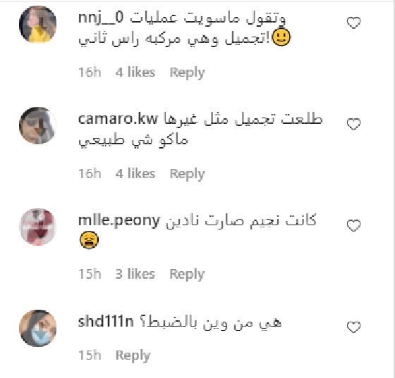فيديو وصور نادين نجيم قبل وبعد: الجمهور مصدوم! تغييرات واضحة تكشف كثرة عمليات التجميل صورة رقم 1