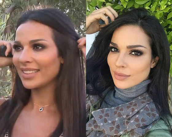فيديو وصور نادين نجيم قبل وبعد: الجمهور مصدوم! تغييرات واضحة تكشف كثرة عمليات التجميل صورة رقم 18