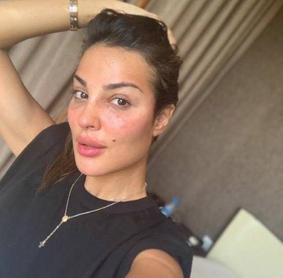فيديو وصور نادين نجيم قبل وبعد: الجمهور مصدوم! تغييرات واضحة تكشف كثرة عمليات التجميل صورة رقم 2