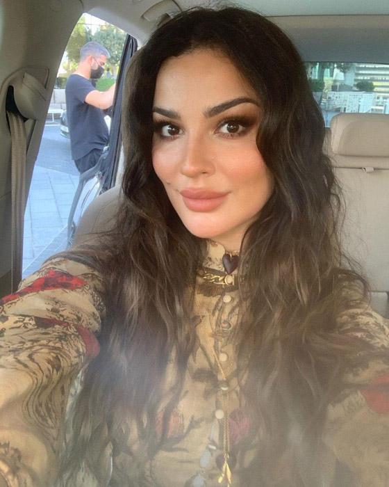 فيديو وصور نادين نجيم قبل وبعد: الجمهور مصدوم! تغييرات واضحة تكشف كثرة عمليات التجميل صورة رقم 23