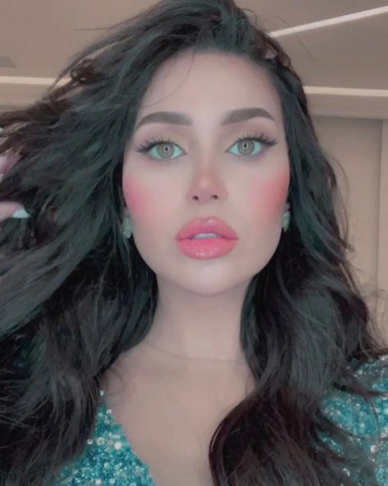 صور فنانات قبل وبعد عملية تجميل الأنف، بينهن نانسي عجرم، نجوى كرم ومي عز الدين صورة رقم 4