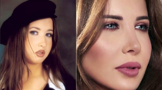 صور فنانات قبل وبعد عملية تجميل الأنف، بينهن نانسي عجرم، نجوى كرم ومي عز الدين صورة رقم 1