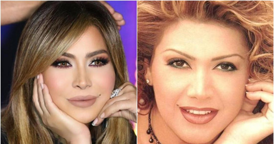صور فنانات قبل وبعد عملية تجميل الأنف، بينهن نانسي عجرم، نجوى كرم ومي عز الدين صورة رقم 5