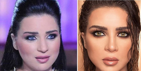 صور فنانات قبل وبعد عملية تجميل الأنف، بينهن نانسي عجرم، نجوى كرم ومي عز الدين صورة رقم 7