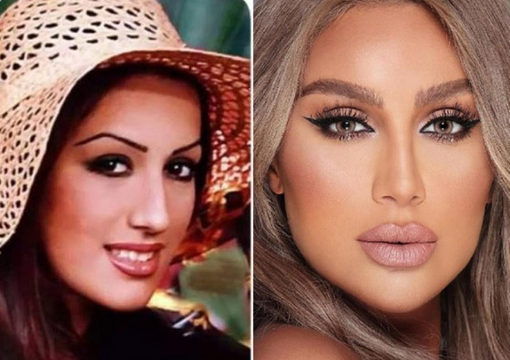 صور فنانات قبل وبعد عملية تجميل الأنف، بينهن نانسي عجرم، نجوى كرم ومي عز الدين صورة رقم 8