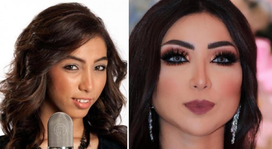 صور فنانات قبل وبعد عملية تجميل الأنف، بينهن نانسي عجرم، نجوى كرم ومي عز الدين صورة رقم 9