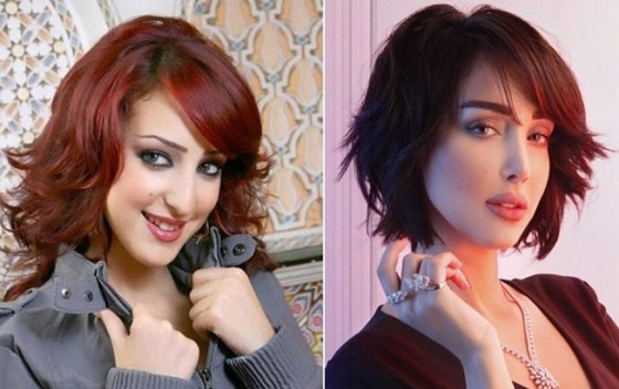 صور فنانات قبل وبعد عملية تجميل الأنف، بينهن نانسي عجرم، نجوى كرم ومي عز الدين صورة رقم 11